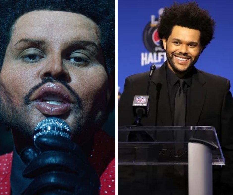 This Is The Real Secret Behind The Weeknd’s Face