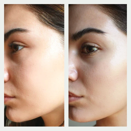 https://d3vlxf0ngetfml.cloudfront.net/blog-media/original_images/resurfacing-serum-before-after.webp