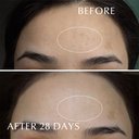 https://d3vlxf0ngetfml.cloudfront.net/compressed/blog-media/original_images/03-EXCIA-Brightening-Immaculate-Serum-Z_w128.jpg