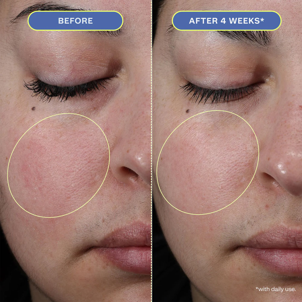 https://d3vlxf0ngetfml.cloudfront.net/compressed/blog-media/original_images/Moisture-Melt-Serum-Balm-03.jpg