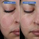 https://d3vlxf0ngetfml.cloudfront.net/compressed/blog-media/original_images/Moisture-Melt-Serum-Balm-03_w128.jpg