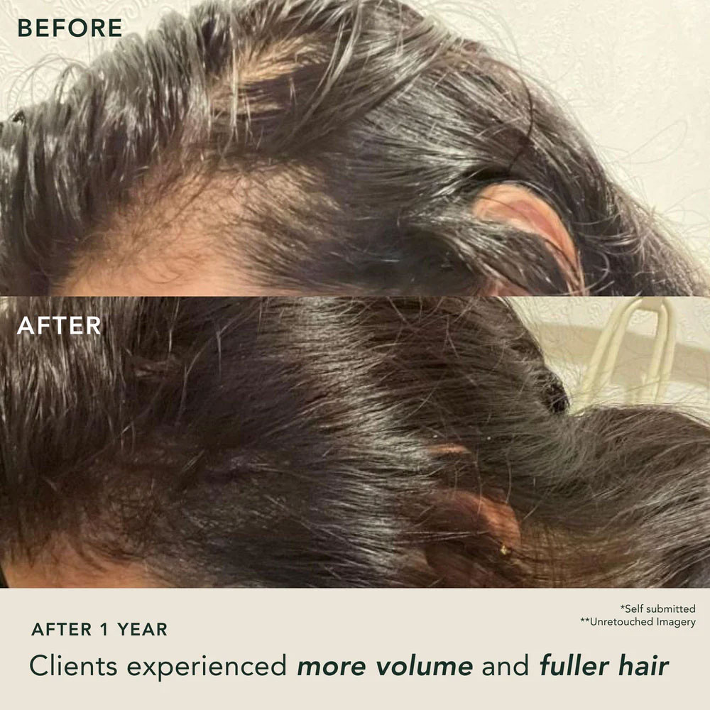 https://d3vlxf0ngetfml.cloudfront.net/compressed/blog-media/original_images/RANAVAT-Fortifying-Shine-Hair-Serum-03.jpg