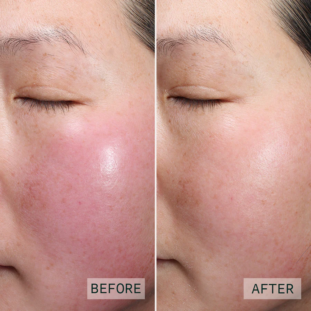 https://d3vlxf0ngetfml.cloudfront.net/compressed/blog-media/original_images/RETINOL-PEPTIDE-BOOSTING-SERUM-03.png